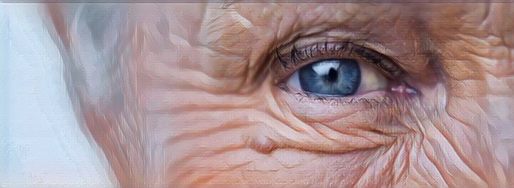 Заболевания глаз у пожилых - Дом престарелых в Крыму