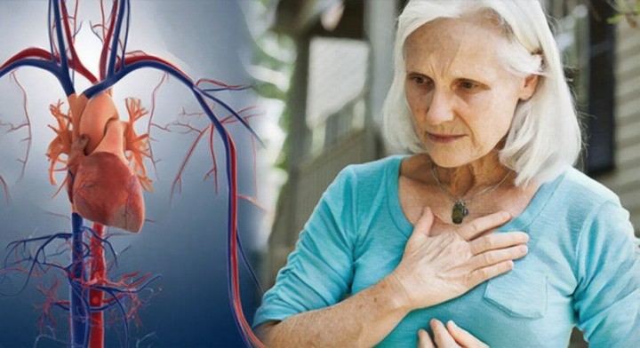 Уход за больными после инфаркта миокарда - Дом престарелых в Крыму